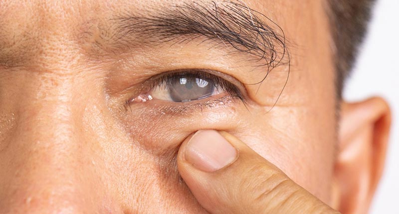cataract adult pediatric eyecare local eye doctor near you.jpg cataract adult pediatric eyecare local eye doctor near you.jpg